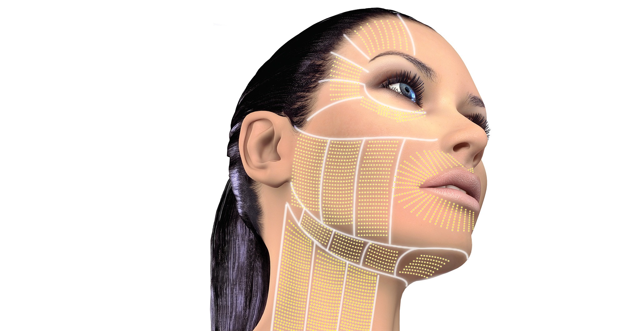 Acquisition of Ulthera